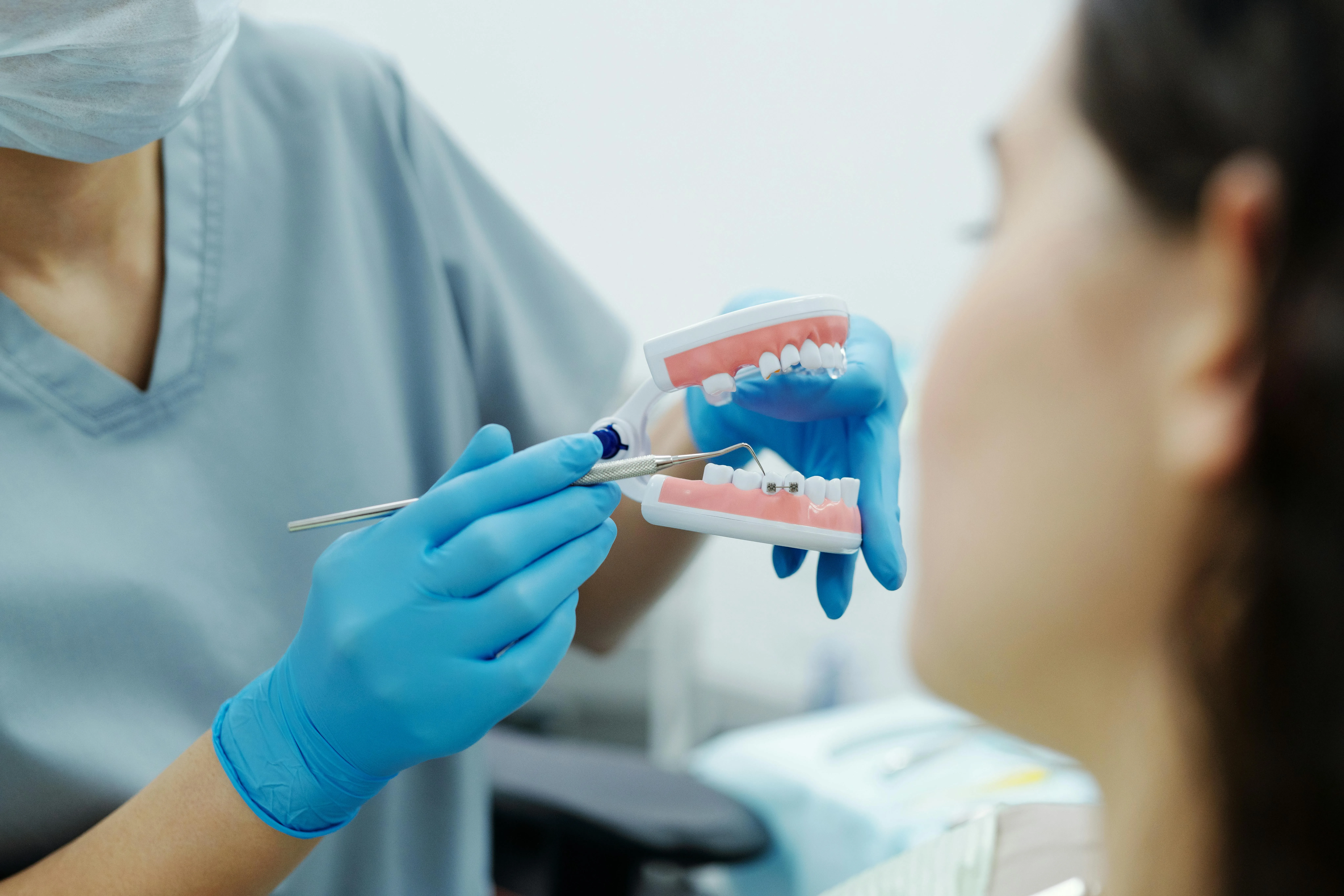Porcelain Veneers Lithia: Transform Your Smile with Tampa’s Top Dentist