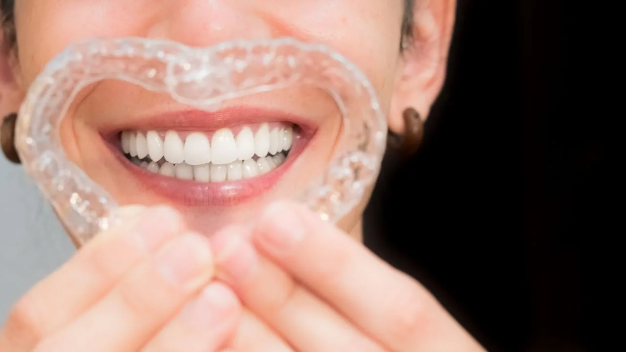 The Science Behind Clear Aligners: How They Move Teeth Gradually