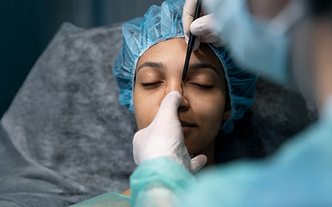 How to Choose the Best Rhinoplasty Surgeon in Whitefield, Bangalore