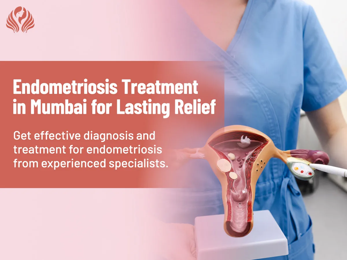 Endometriosis Treatment: 9 Frequently Asked Questions Every Woman Should Know