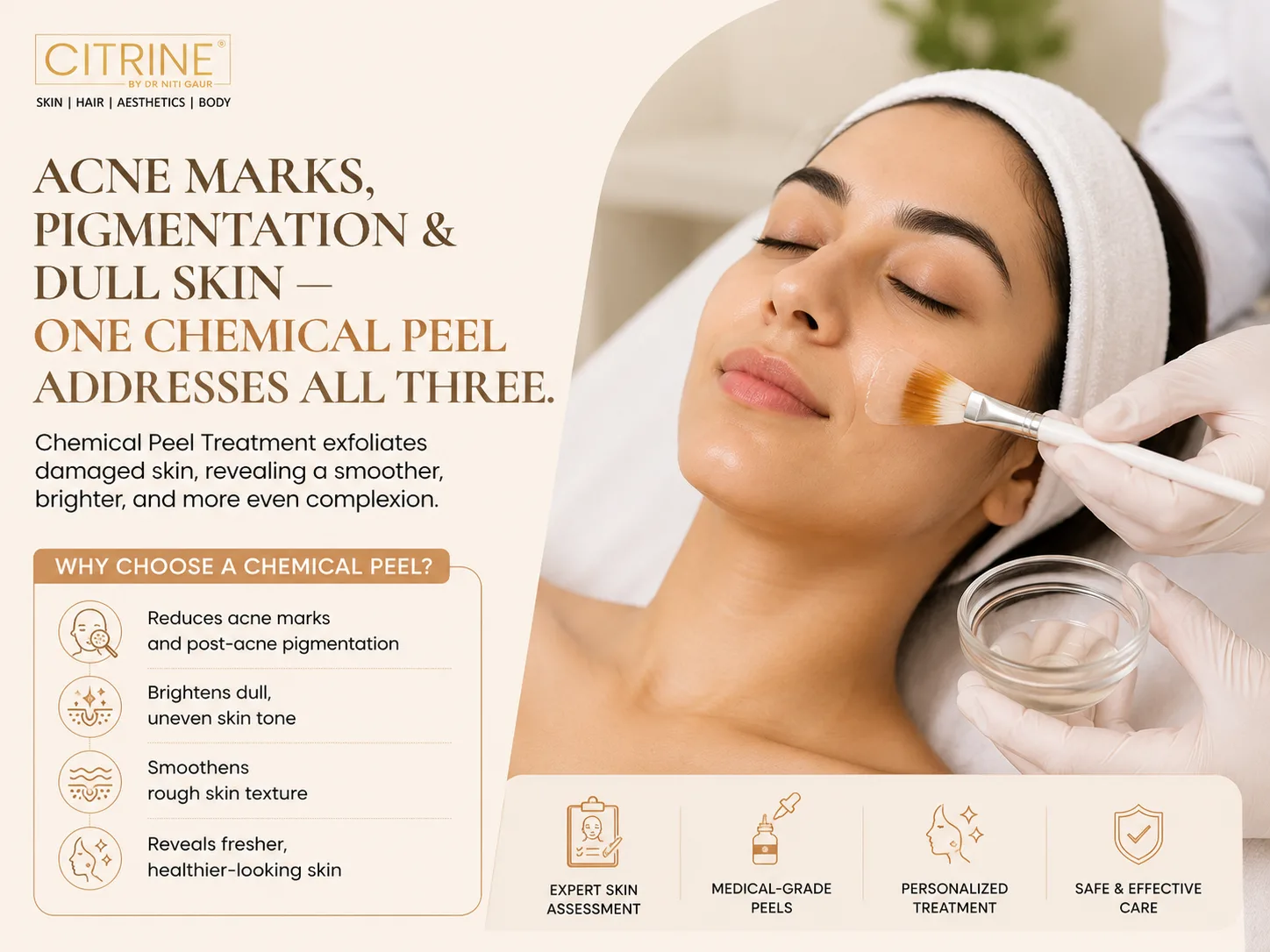 Acne Marks, Pigmentation, Dull Skin — One Chemical Peel Addresses All Three