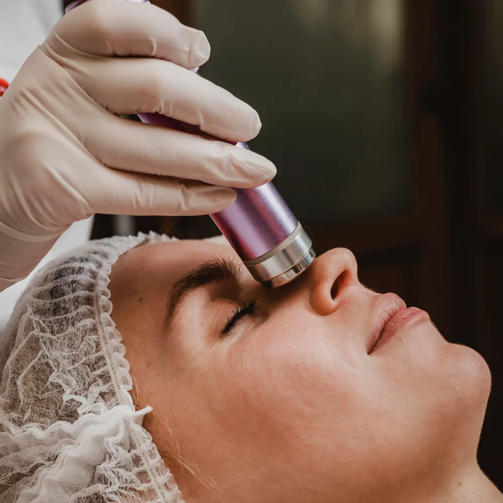 10 Skin Concerns Microneedling Can Help Improve Naturally