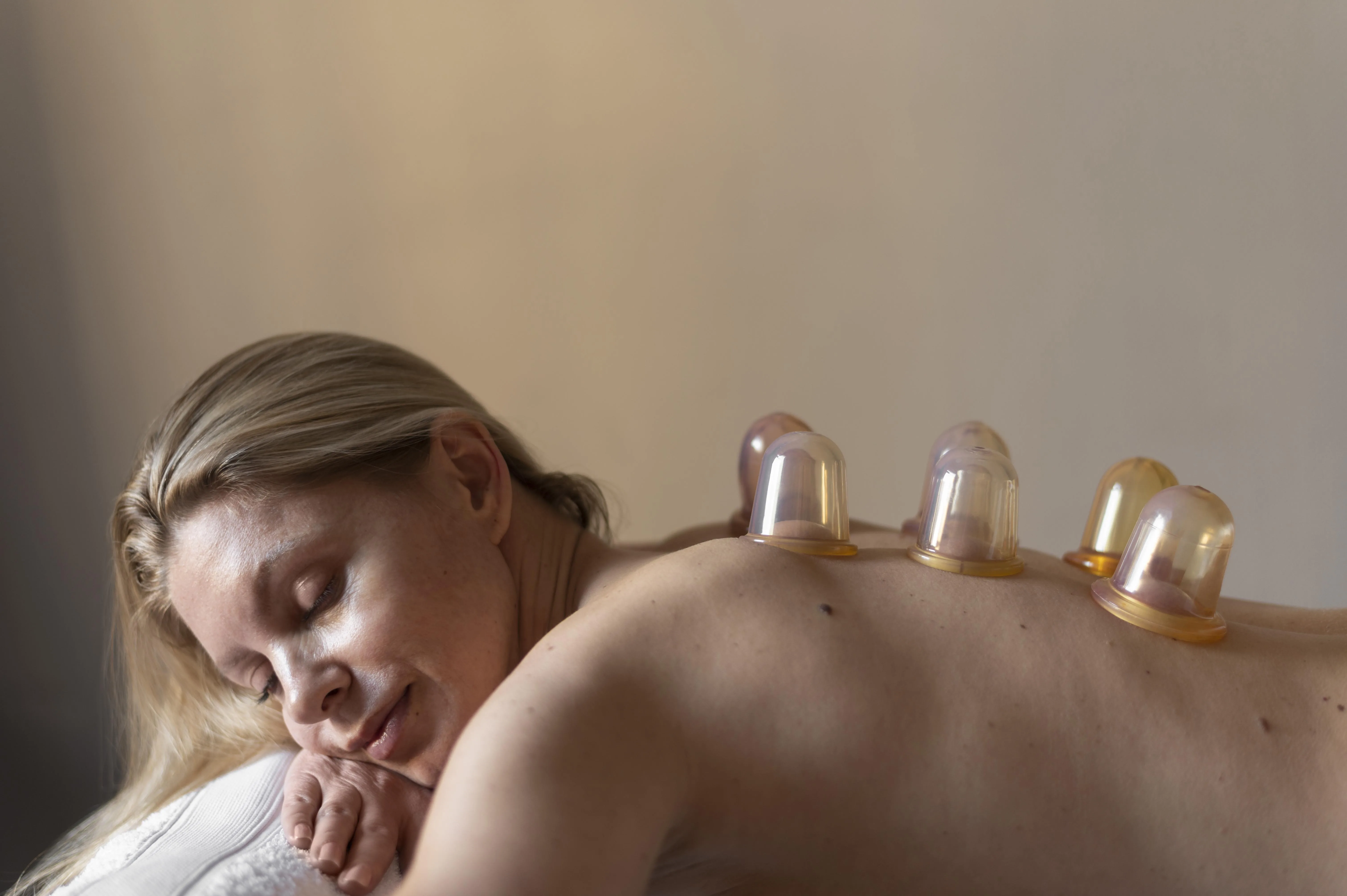 How Acupuncture Supports a Healthier and More Balanced Life
