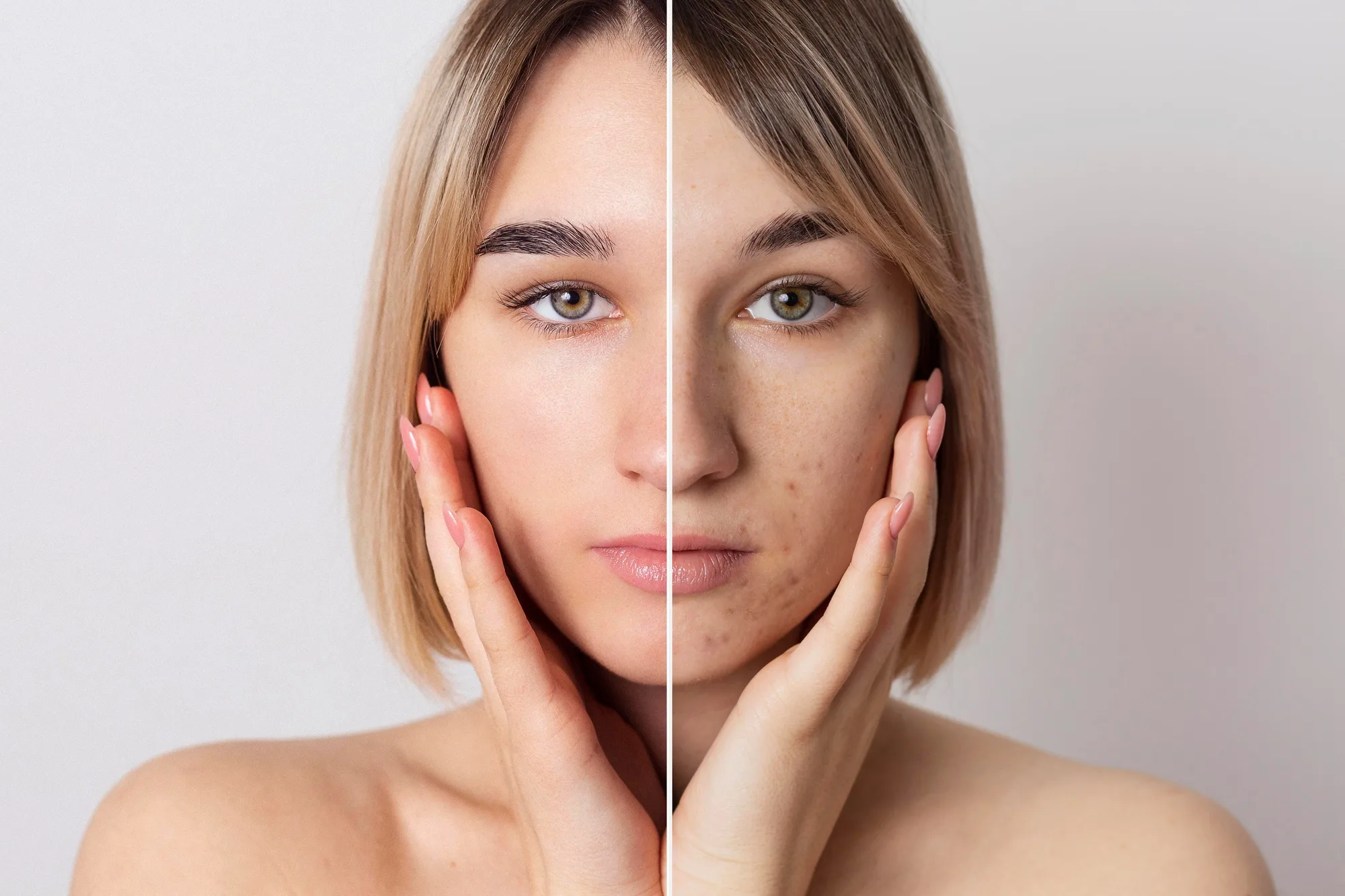 Doctor-Approved Ways to Get Rid of Hyperpigmentation
