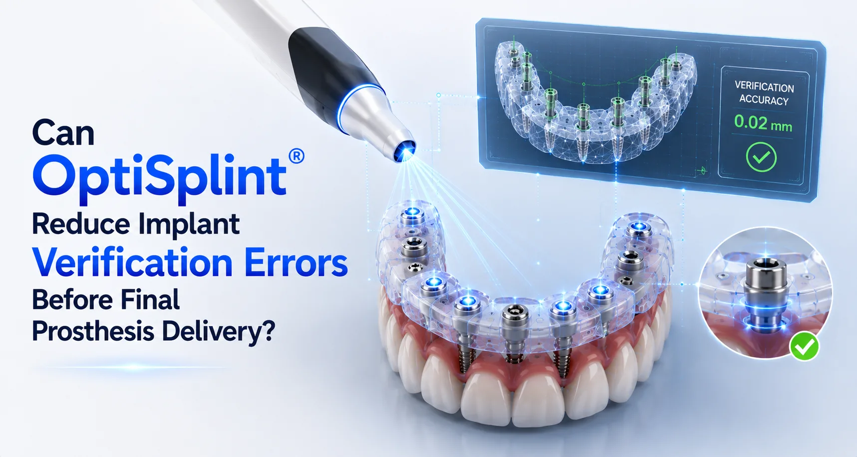 Can OptiSplint® Reduce Implant Verification Errors Before Final Prosthesis Delivery?