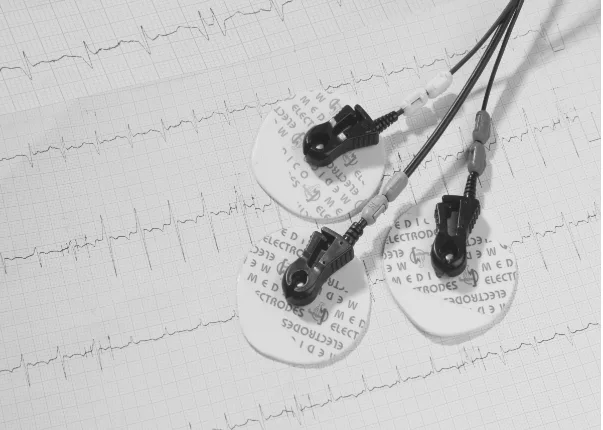 What Makes Medico and Snap Electrodes the Best Choice for ECG Solutions?