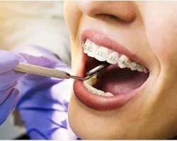 Navigating Oral Healthcare: Finding the Right Dentist in Lahore