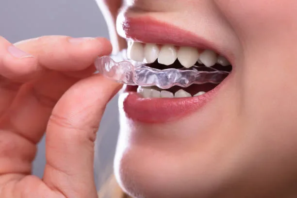 Why Choosing a New Canaan Orthodontist Can Transform Your Smile and Oral Health