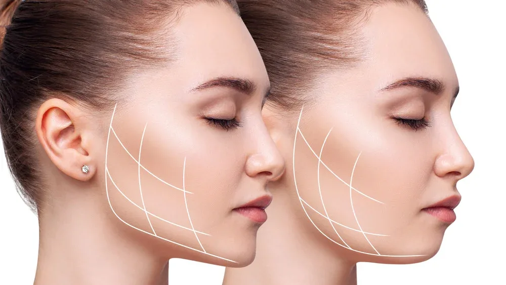 Your Roadmap to Facial Contouring: What to Expect Before, During, and After Buccal Fat Removal Surgery