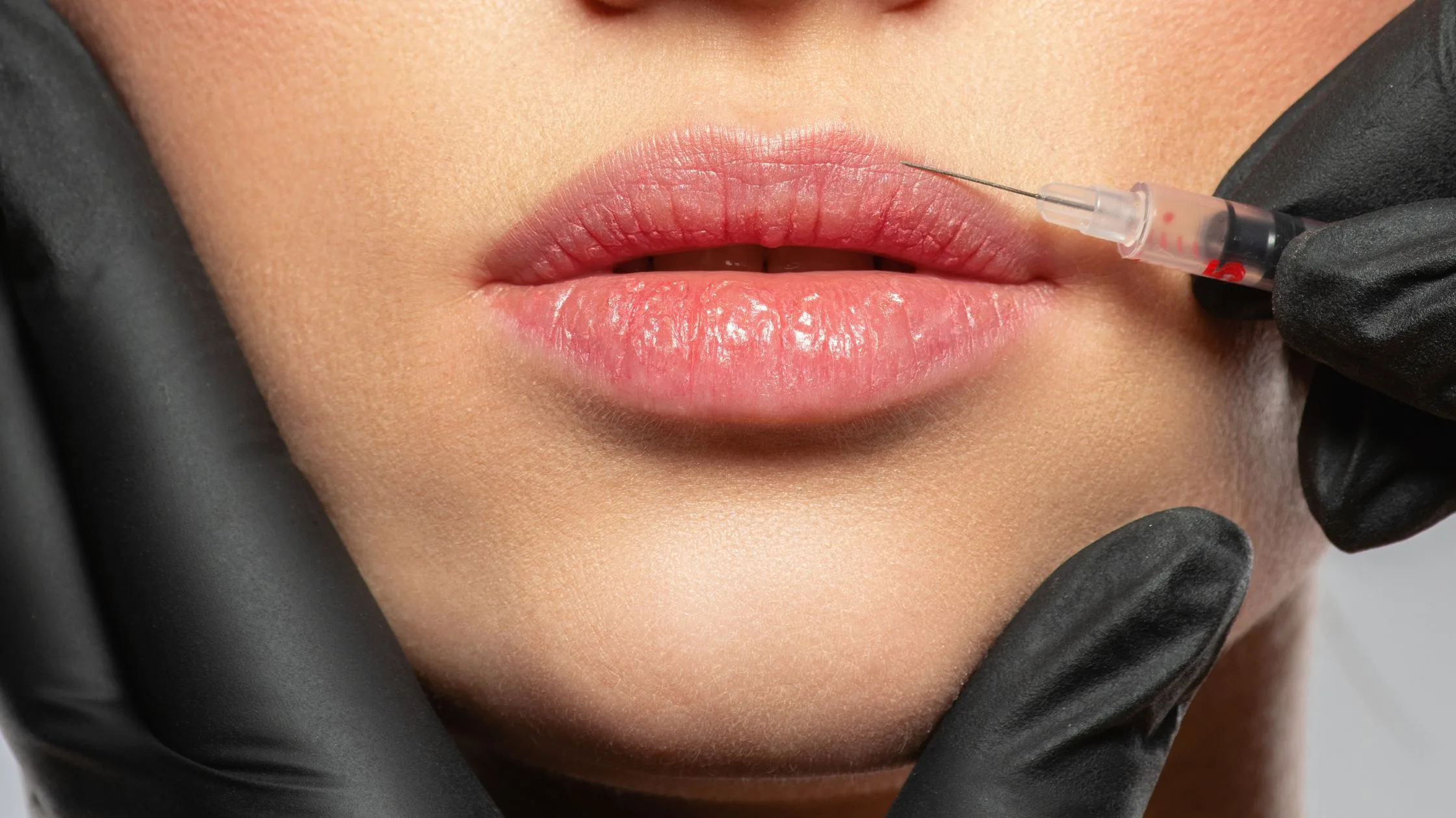 Lip Reduction Surgery in Delhi: How to Achieve Natural-Looking and Balanced Facial Features