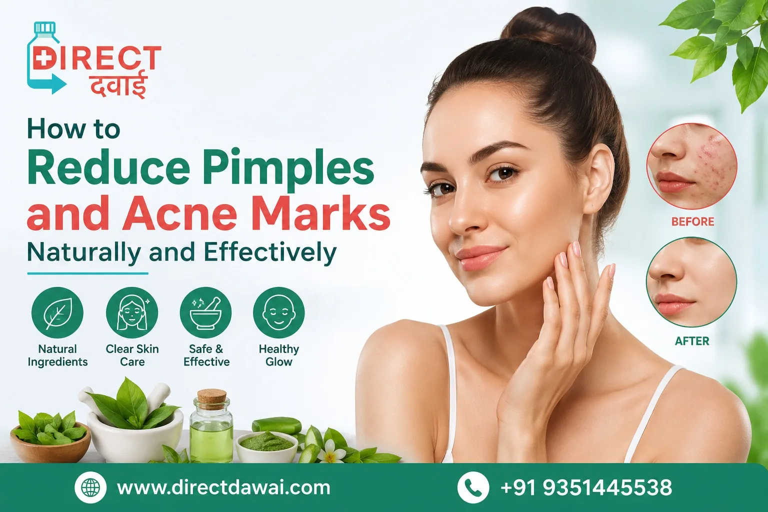 How to Reduce Pimples and Acne Marks Effectively