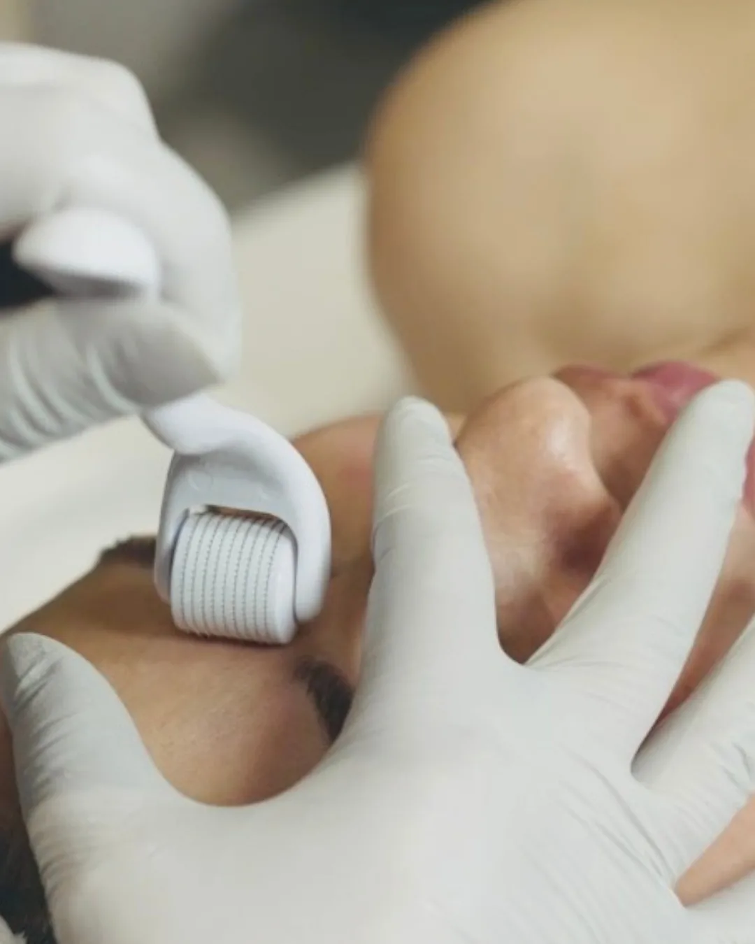 Why Microneedling Certification Can Boost Your Professional Career?