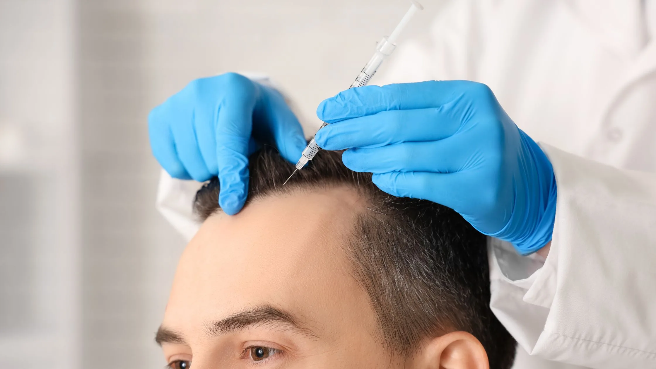 How Can Hair Transplant in Navi Mumbai Help You Achieve Permanent Hair Restoration?