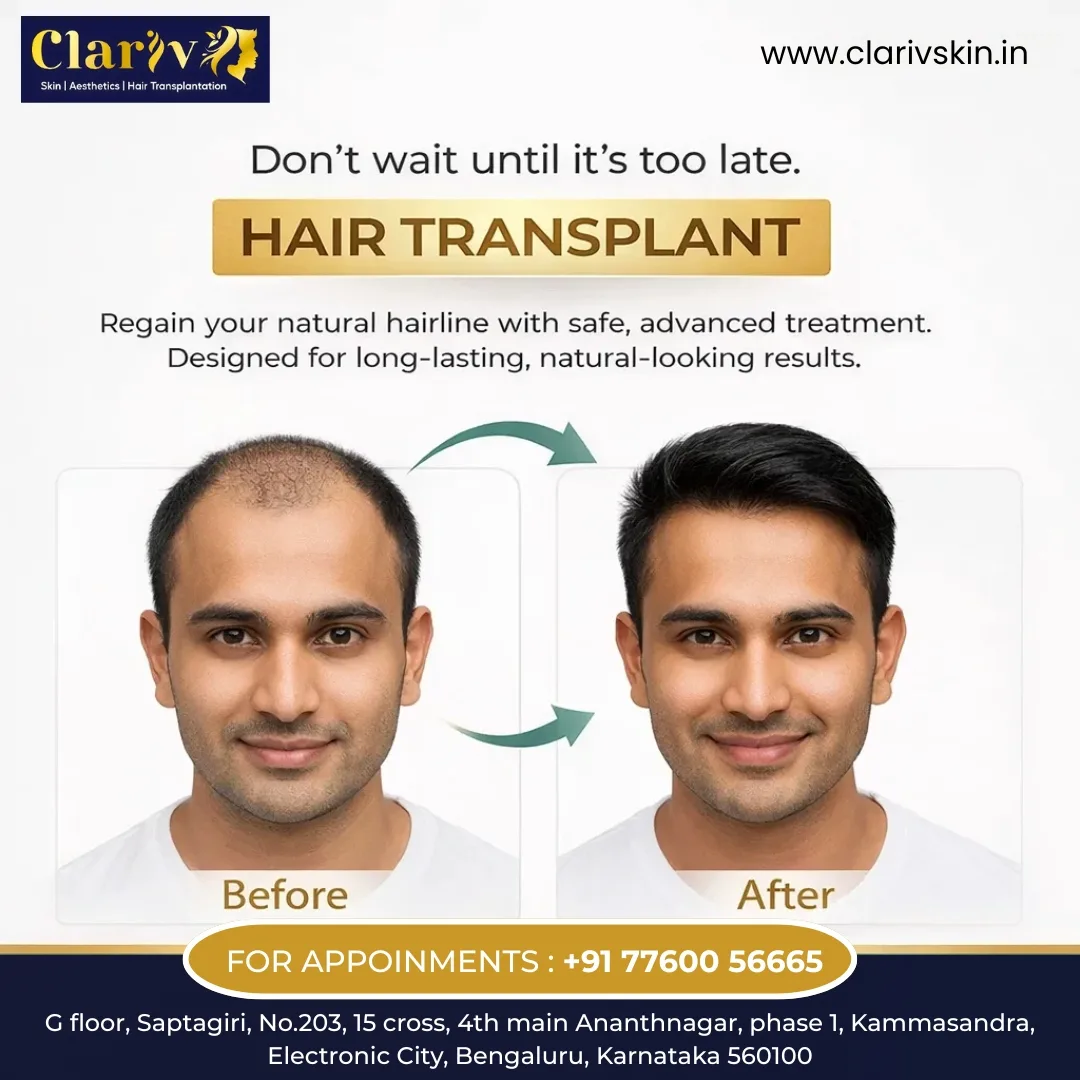 The Complete Guide to Choosing a Hair Transplant Clinic HSR Layout, Bangalore | Clarivskin.in
