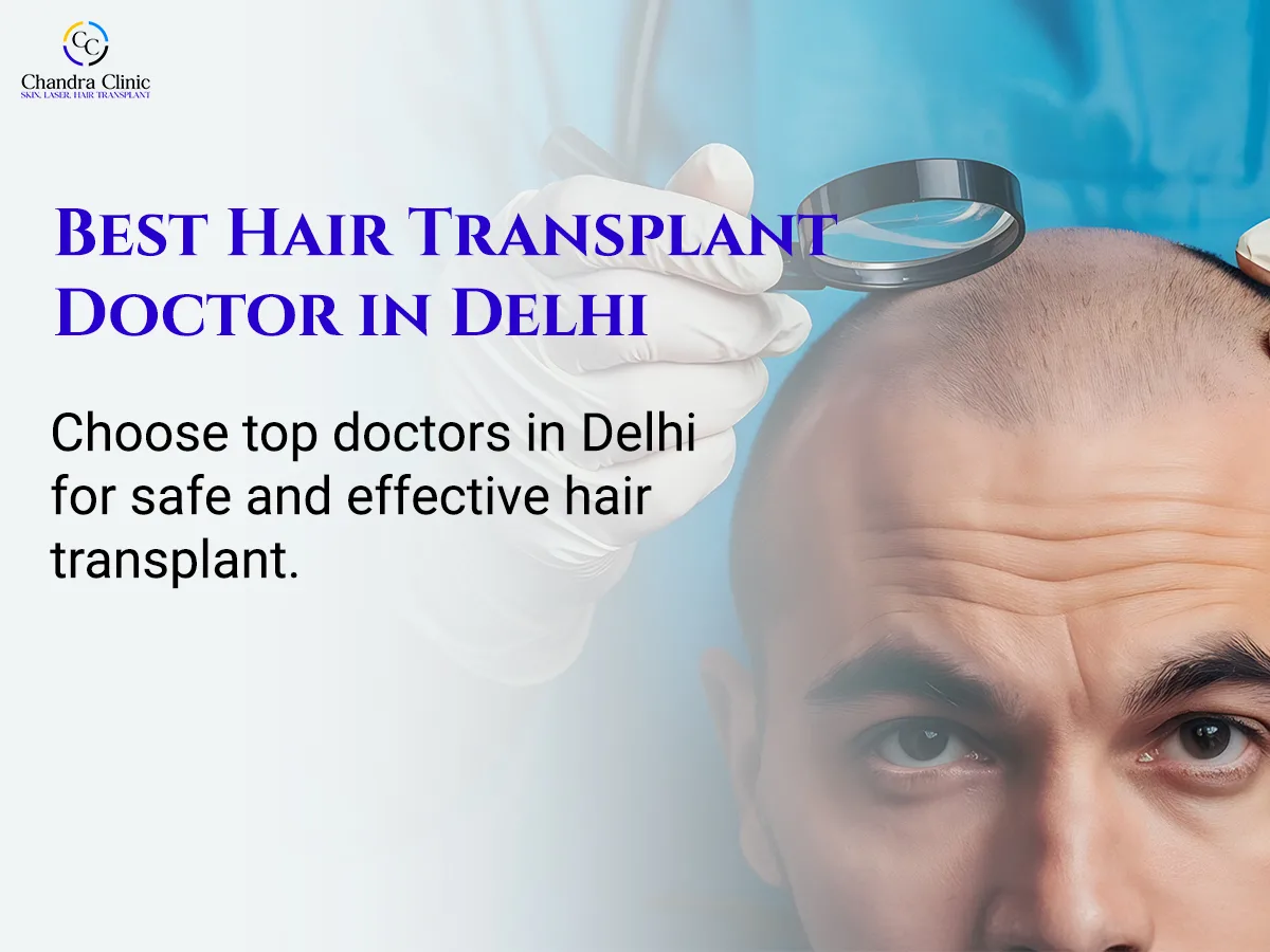 How to Find a Trusted Hair Transplant Doctor in Delhi for Natural Results