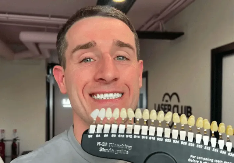 Teeth Whitening Manchester: How Long Do Results Really Last?