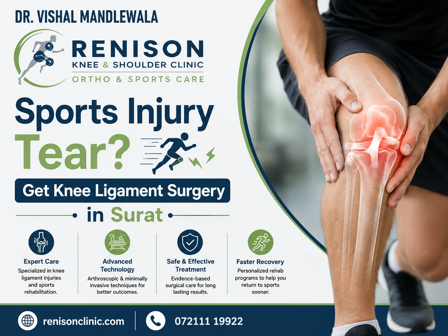 Knee Ligament Surgery in Surat: When Is Surgery the Best Option for a Stable, Pain-Free Knee?