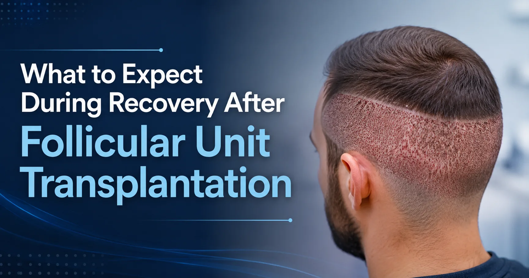 What to Expect During Recovery After Follicular Unit Transplantation