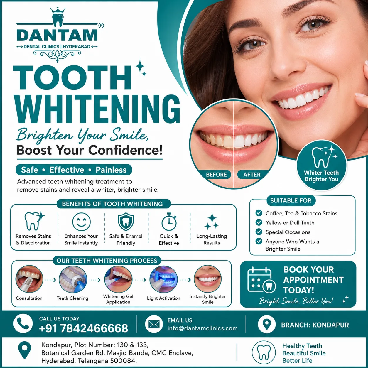 Trusted Tooth Whitening Treatment in Kondapur with Personalized Cosmetic Dental Care.