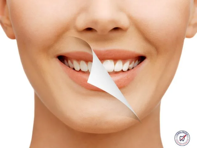 How to Start a Teeth Whitening Business: A Complete Step-by-Step Guide for Success