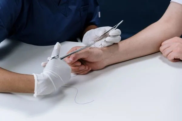 Ganglion Surgery Singapore: A Practical Guide to Treatment and Recovery