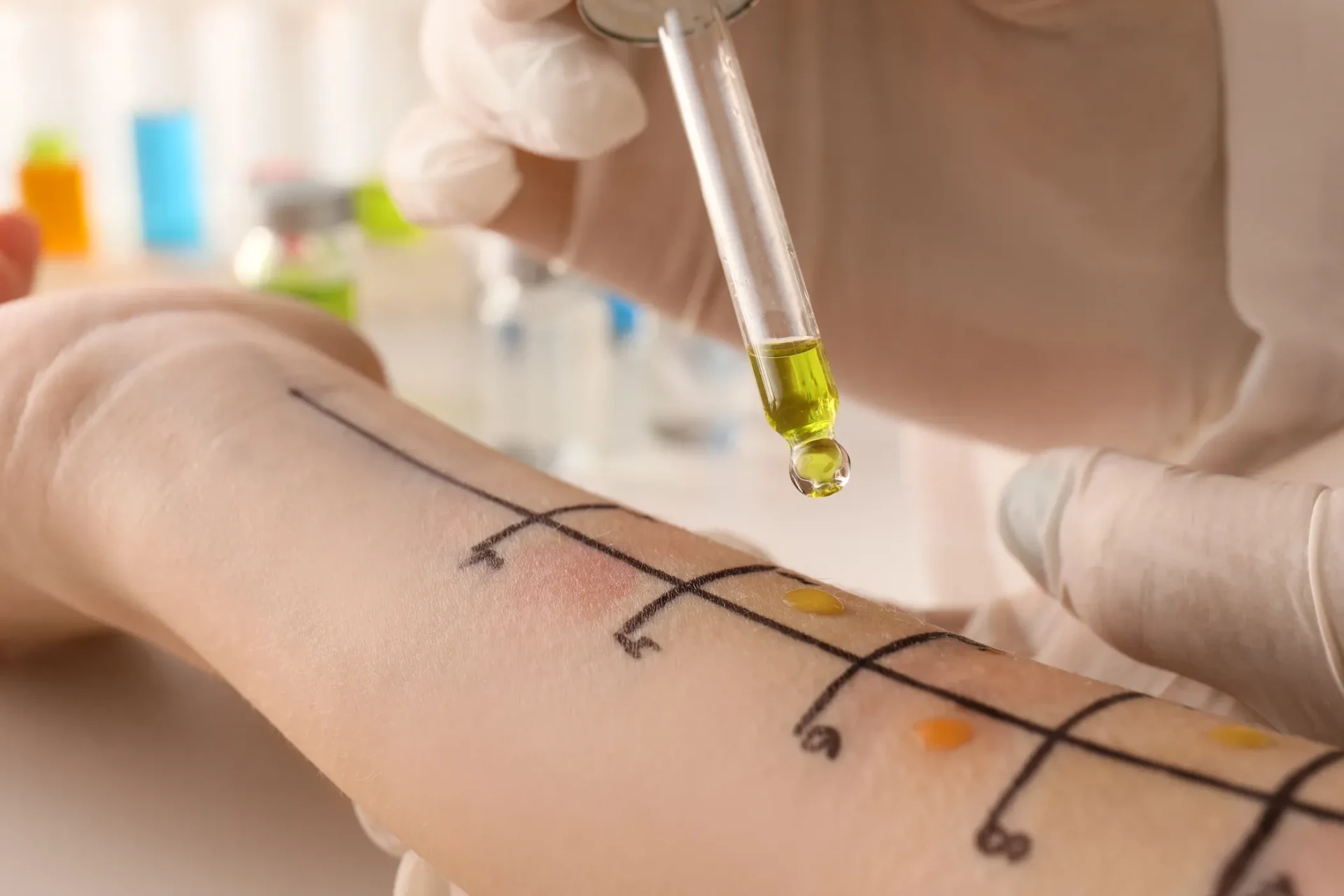 Food Allergy Testing Techniques You Should Know