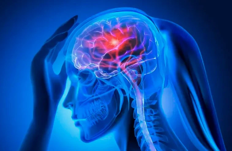 What is the 4-Hour Rule for Choke Stroke Treatment?