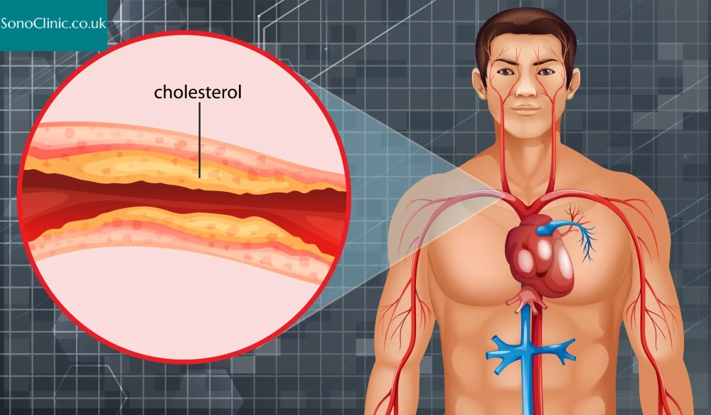 Carotid Artery Scan: 5 Early Blockage Signs You Mustn't Ignore