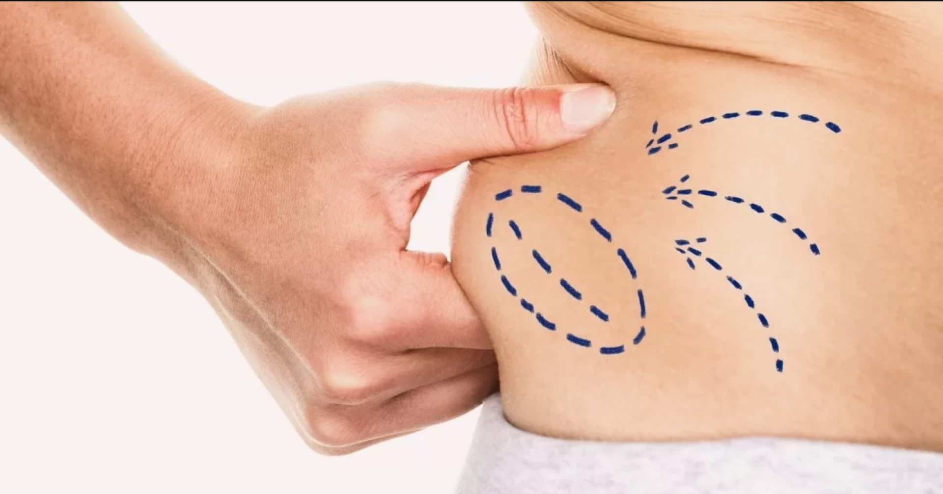 Behind the Scenes Exploring the Scientific Principles of Liposuction in Dubai