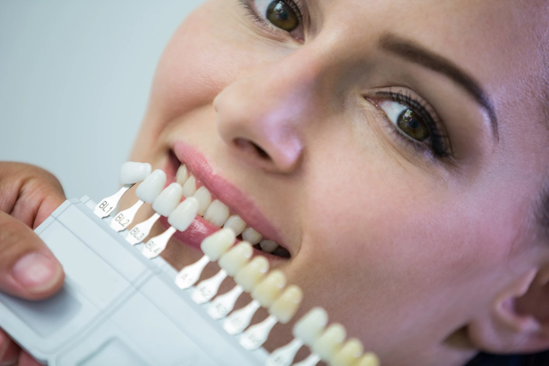 Top 7 Benefits of Dental Implants for Long-Term Oral Health 