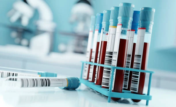Top 10 Diagnostic Labs in Panchkula for Accurate Test Results
