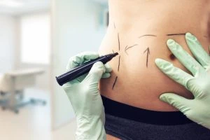 Tummy Tuck Cost in Dubai: Is It Worth It?