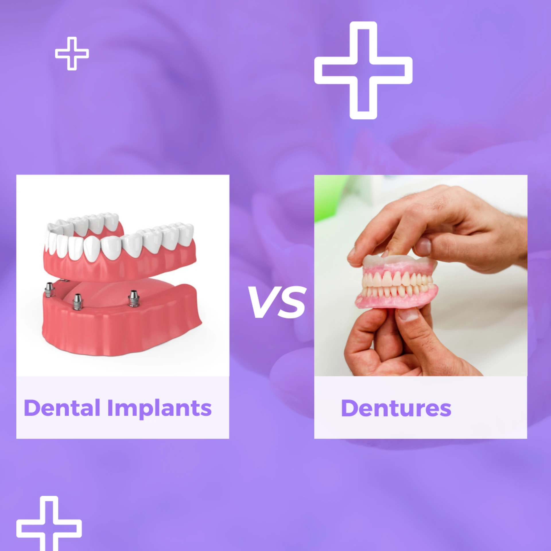 Dental Implants vs. Dentures: What’s the Best Choice for You? 