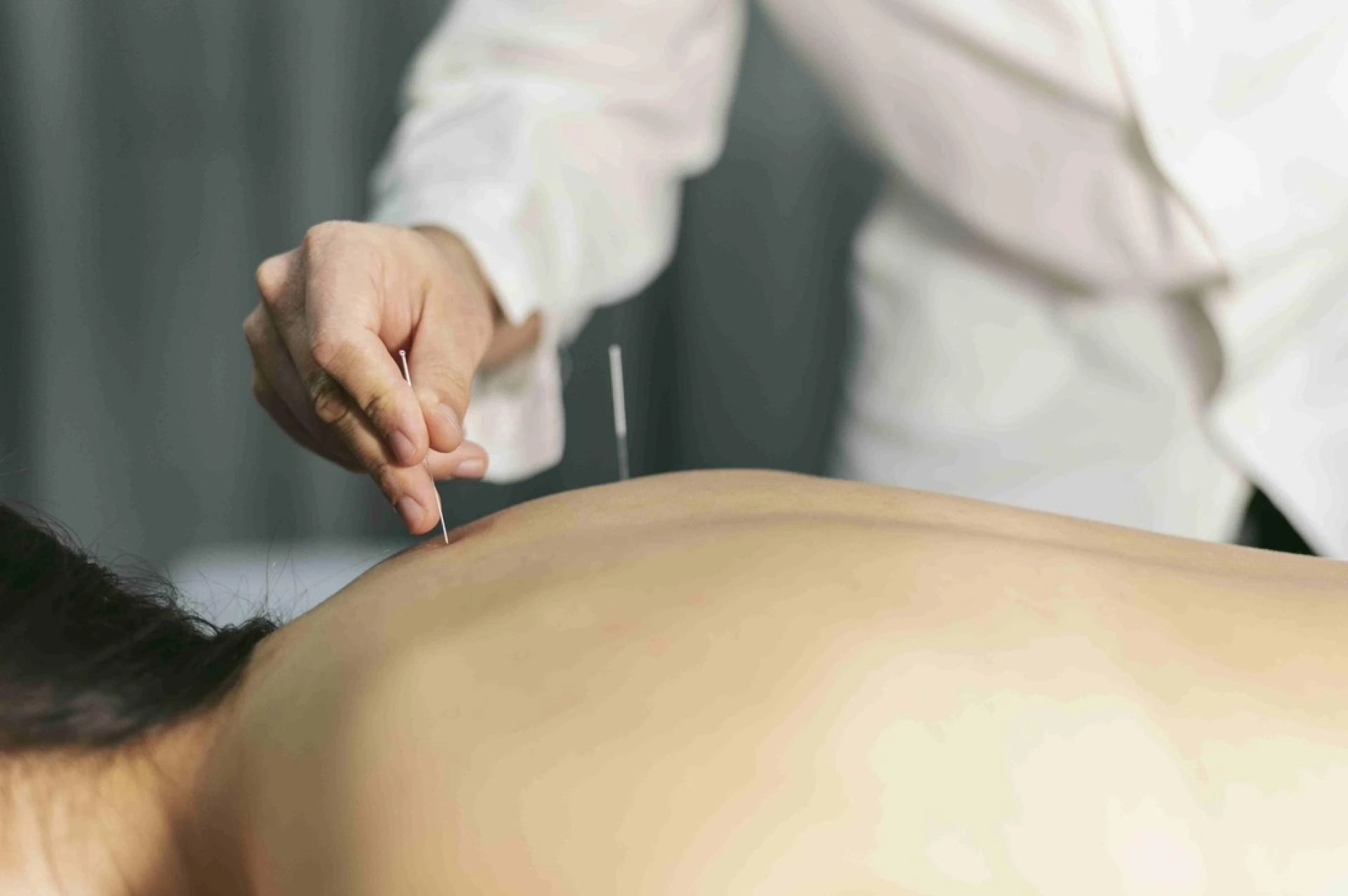 Can Acupuncture Improve Egg Quality? Here's What You Need to Know