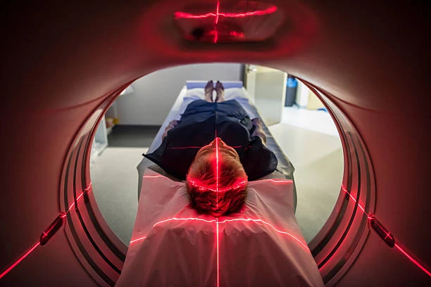 MRI Scan in Delhi: Everything You Need to Know Before Booking