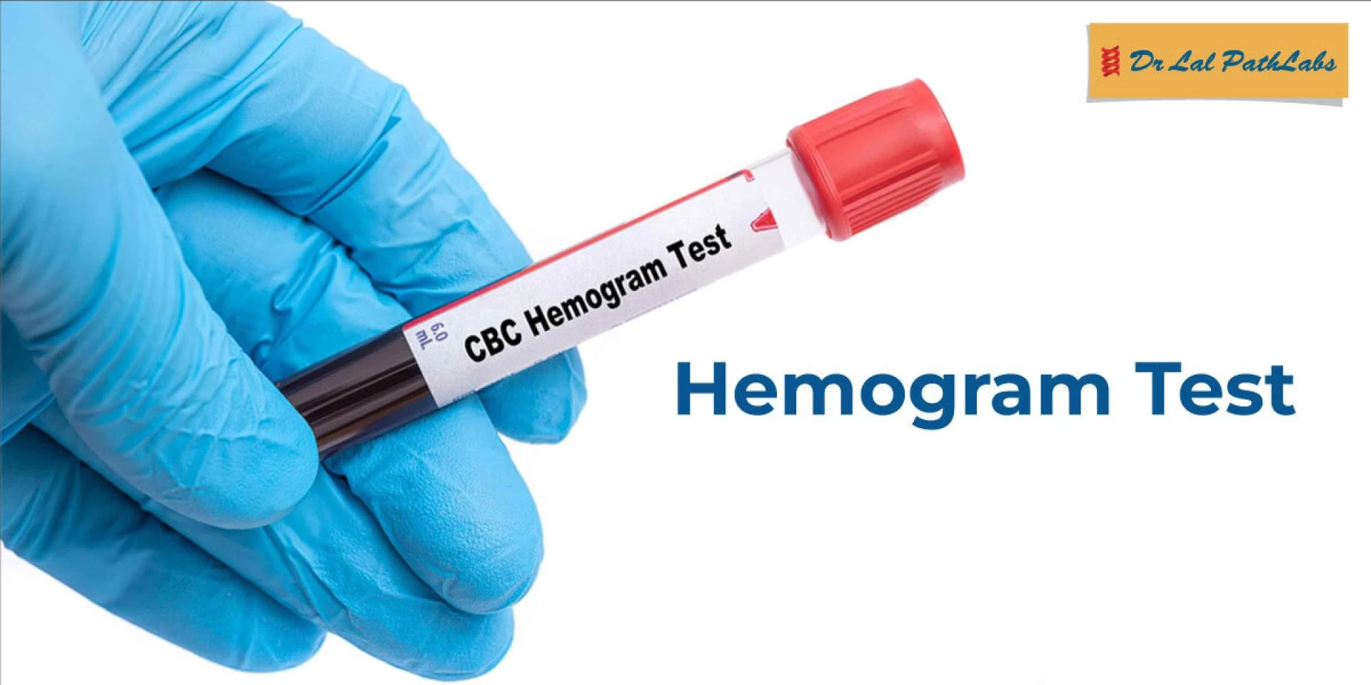 Important Facts You Need to Know About Haemogram Tests