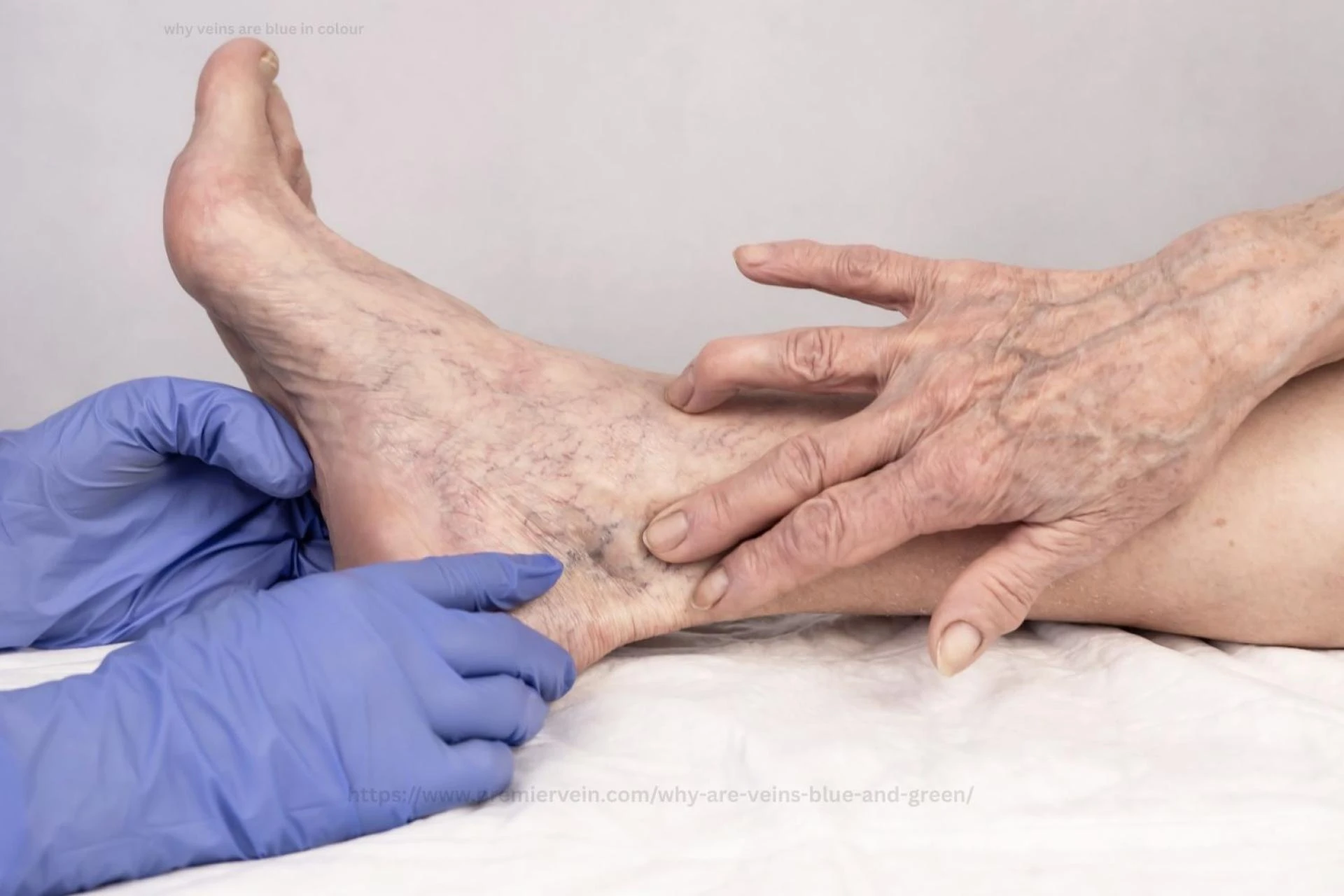 Unlocking Leg Vein Health: GAE Knee Relief, Vein Anatomy & Expert Care in Houston