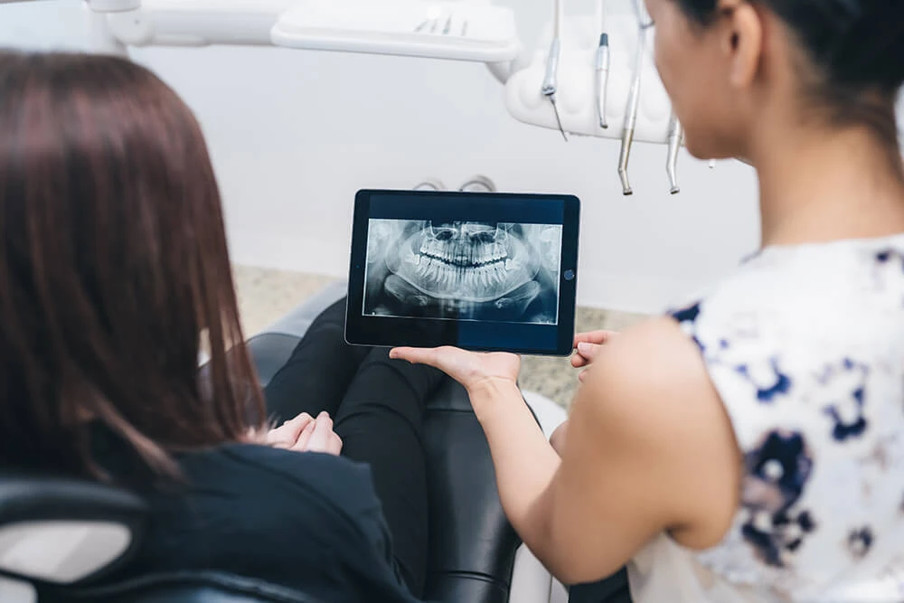 All-on-4 Dental Implants in Melbourne: The Modern Solution for a Full Smile