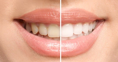 Transform Your Smile with Expert Dental Care in Adelaide