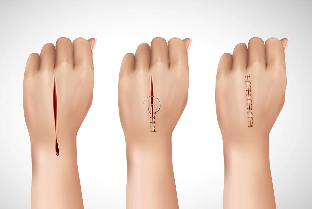  Scar Management Market growth 2025 | Business Outlook 2035