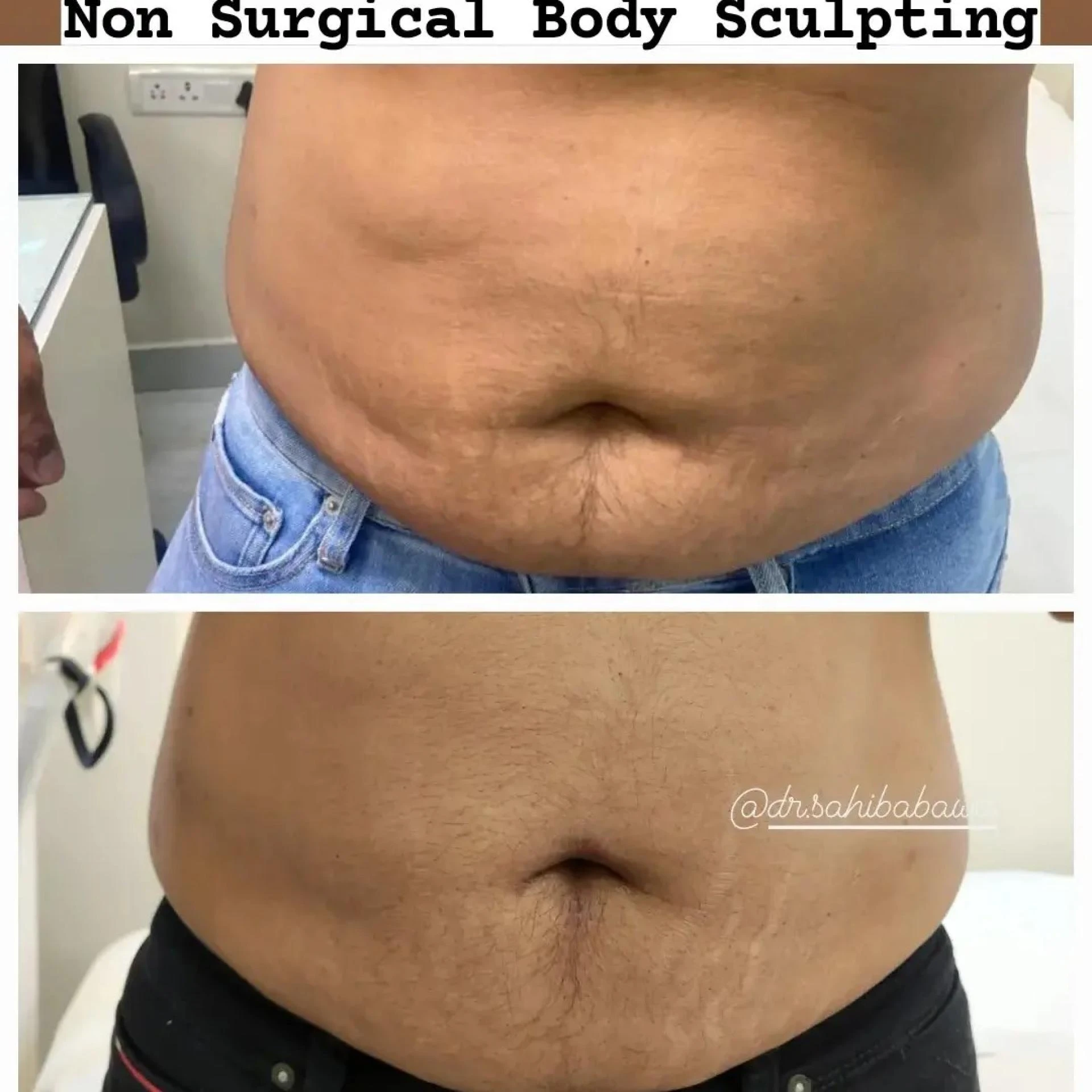 Busy Lifestyle? Here’s How to Achieve Weight Loss in Bhopal Without a Gym!