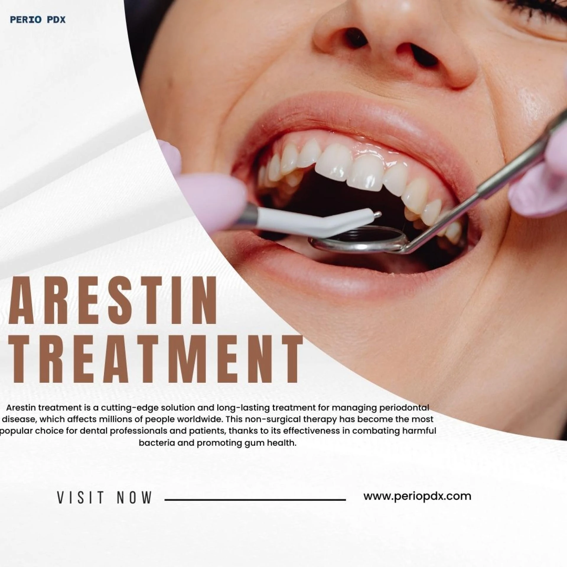  Arestin Treatment : An Advanced Treatment for Gum Disease