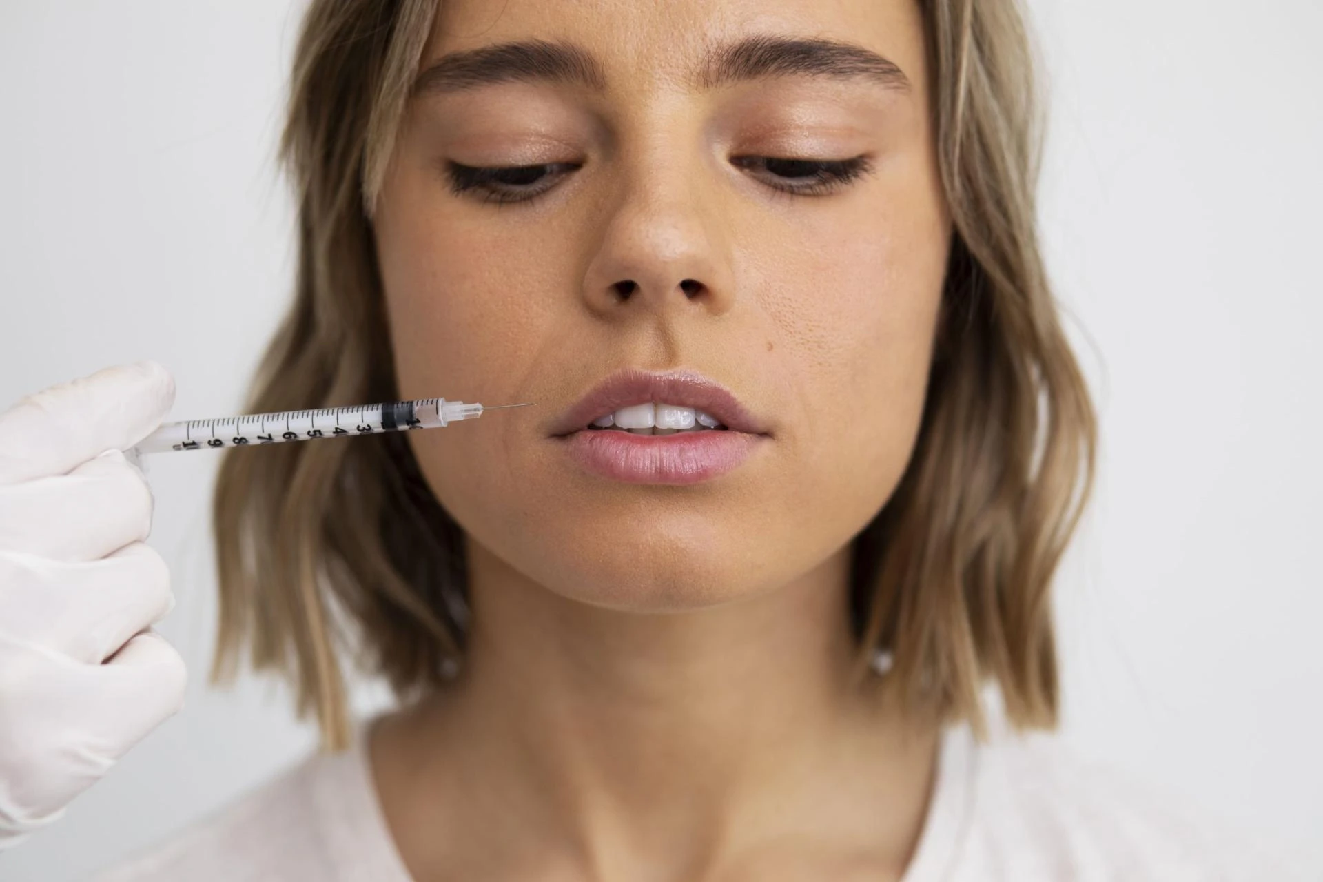 Does PDRN Treatment Work for Acne Scars on Face?