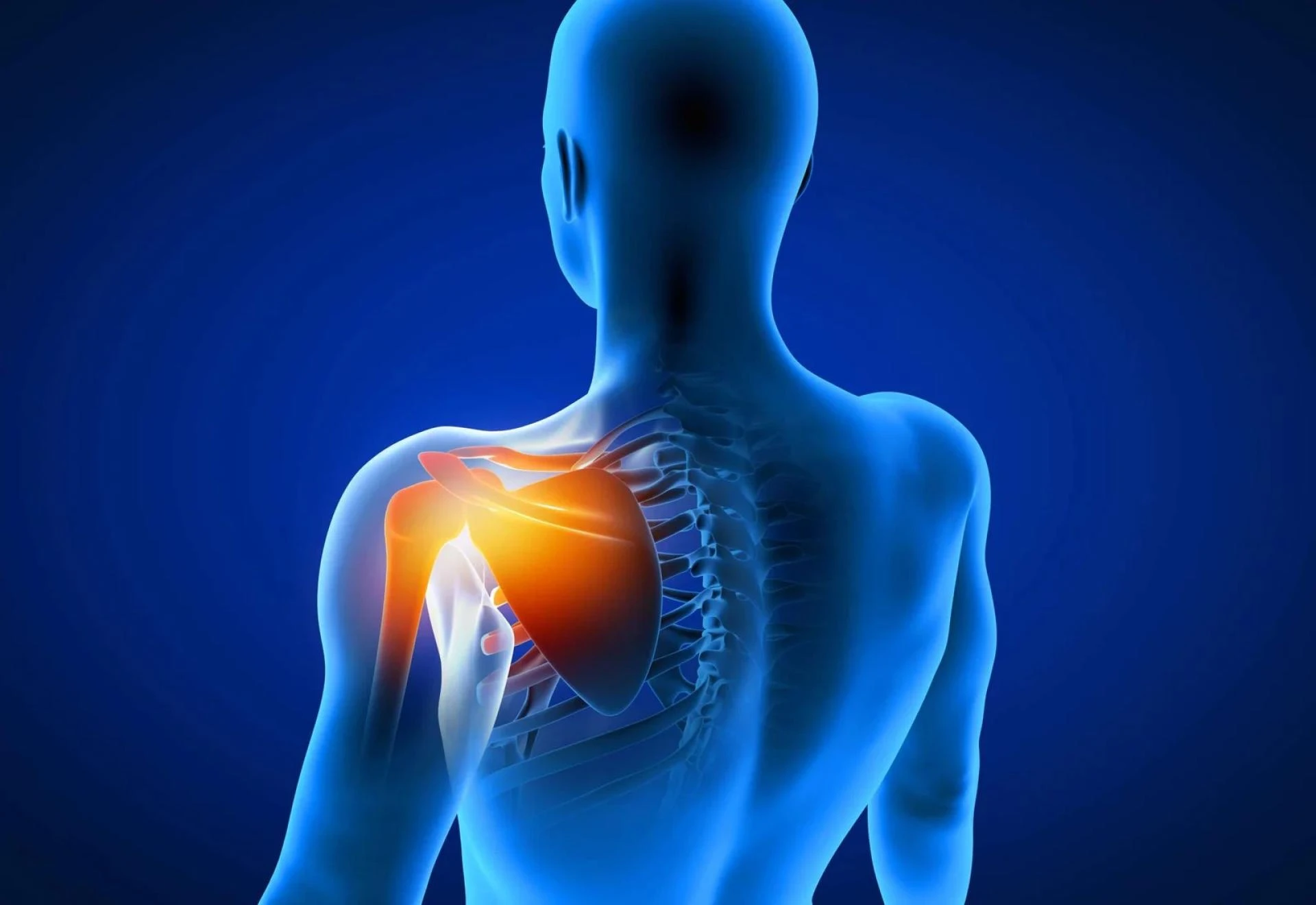 How Good Is Shoulder Replacement Surgery? A Fair Review of Outcomes & Expectations