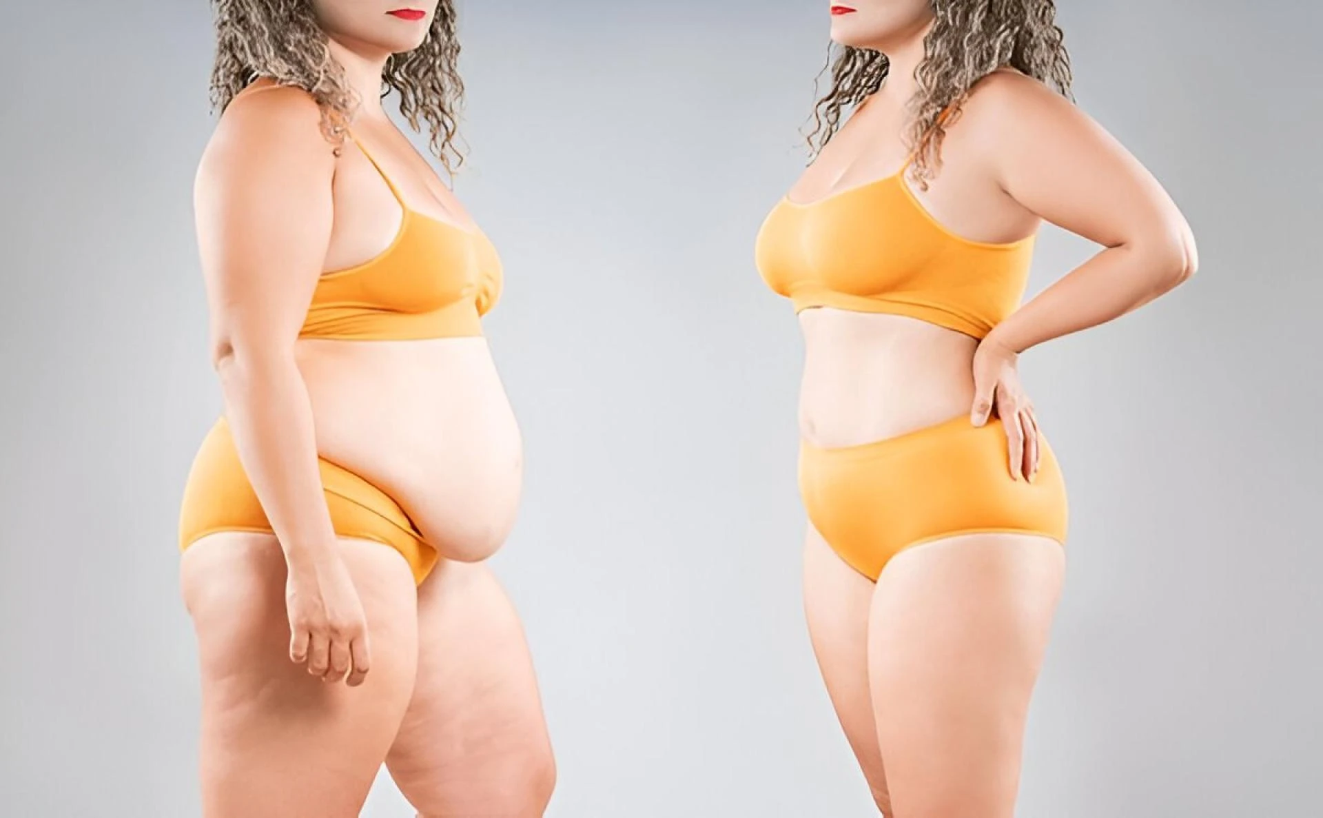 Effective Ways to Speed Up Liposuction Recovery