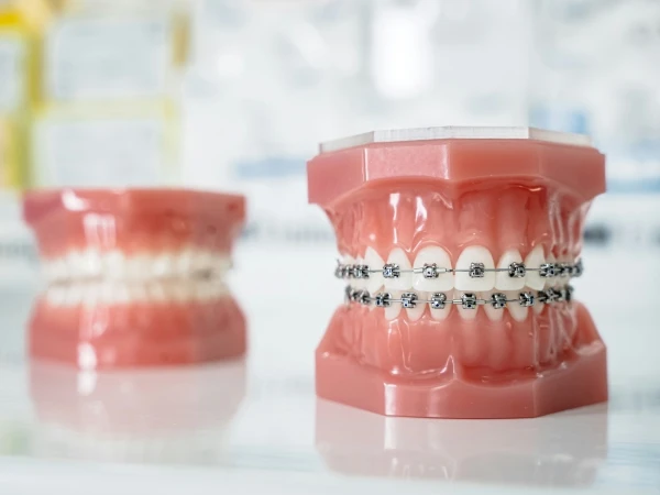 The Game-Changing Benefits of Aesthetic Dentistry Courses