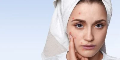 Laser Hair Removal Singapore: A Long-Term Solution for Smooth, Hair-Free Skin