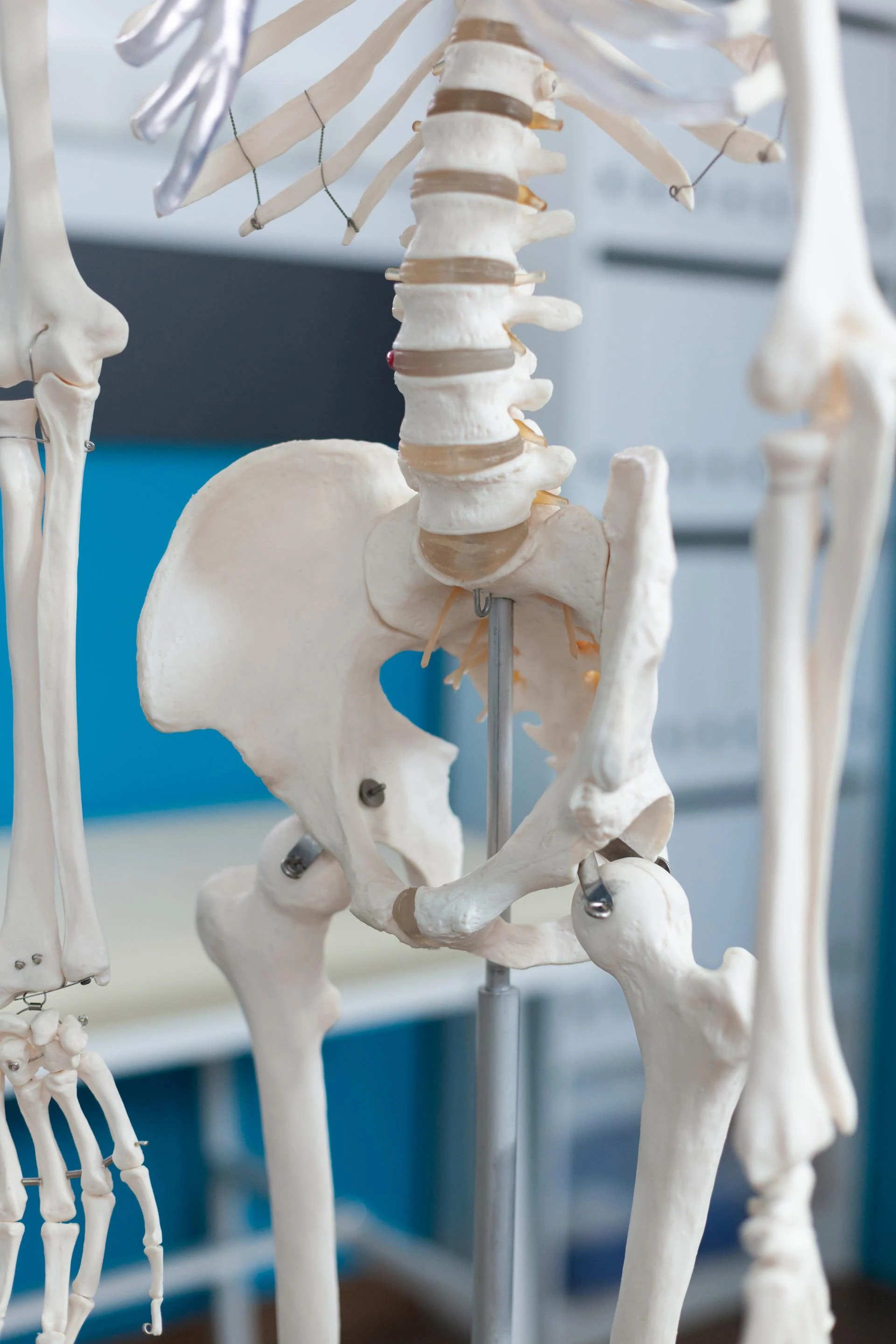 Why Patients Prefer Robotic Hip Replacement Surgery in Ghaziabad