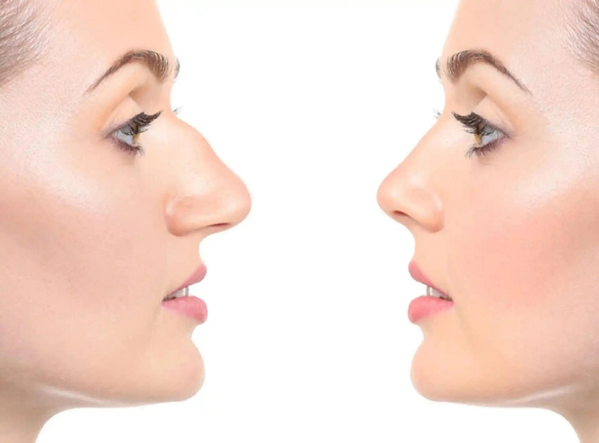 Rhinoplasty in Dubai: Your Path to Refined Beauty and Confidence