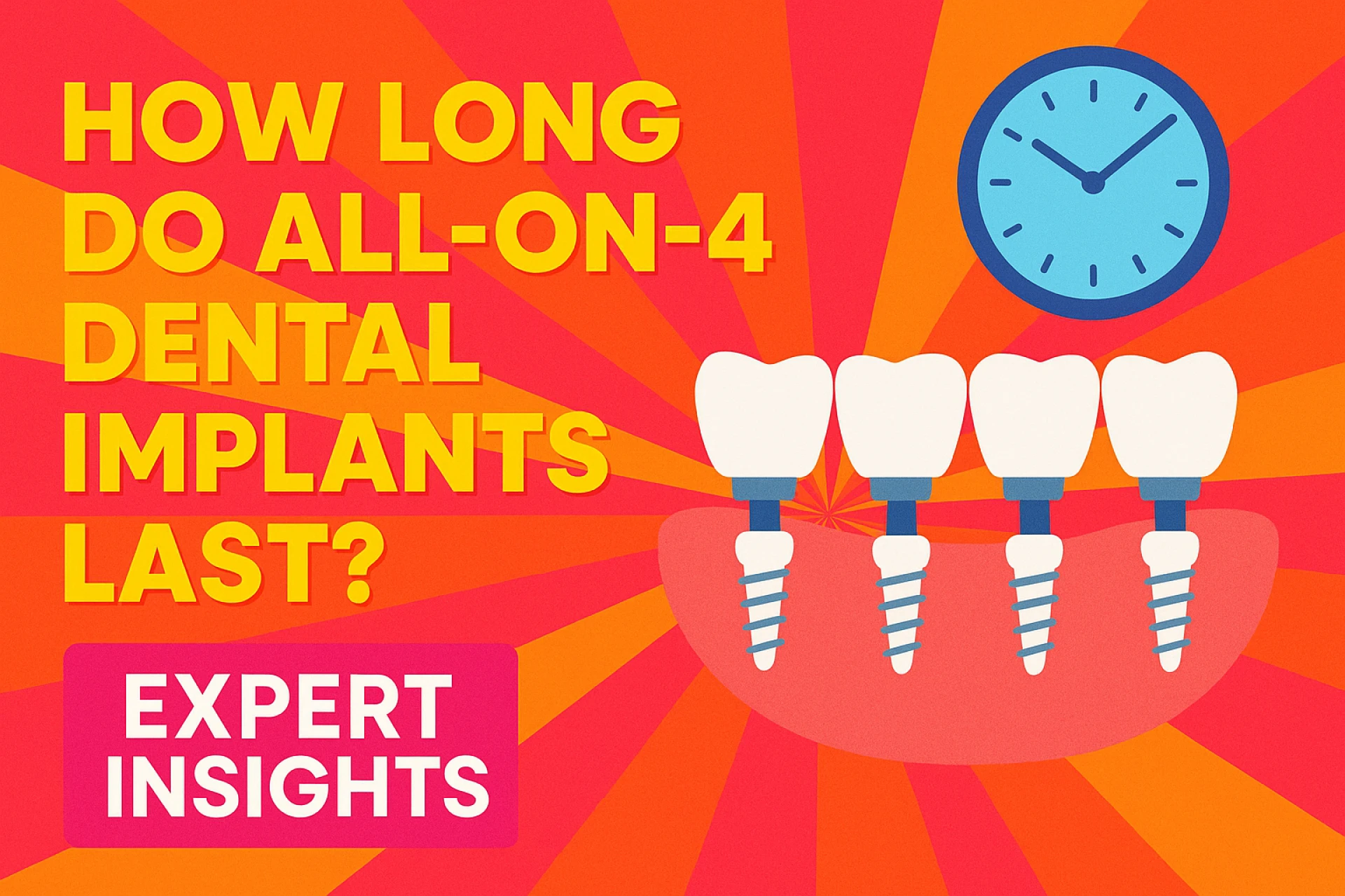 How Long Do All-on-4 Dental Implants Last? Expert Insights